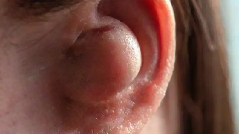 Detalle realista de un pendiente nuevo en oreja
